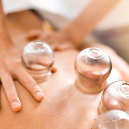 physical-therapy-clinic-cupping-pwr-physio-lenexa-ks