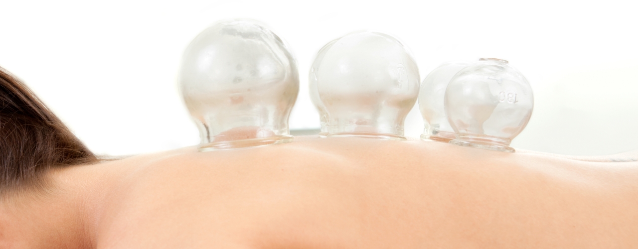 physical-therapy-clinic-cupping-pwr-physio-lenexa-ks